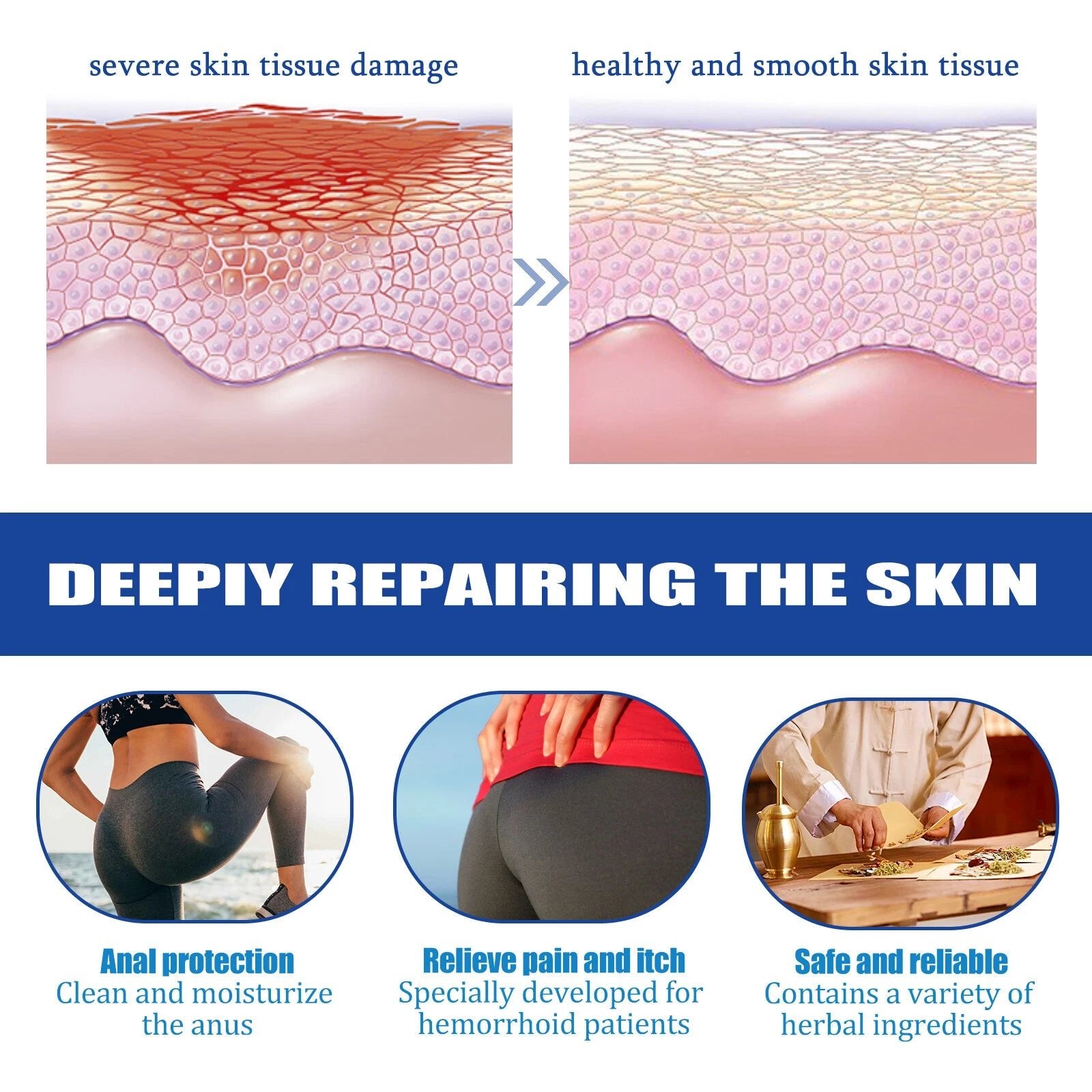 South Moon - Strength Hemorrhoids Capsules (Original) - Zambeel