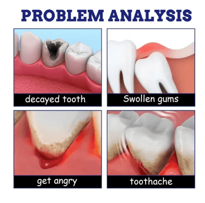 South Moon - Toothache Spray (Original) - Zambeel