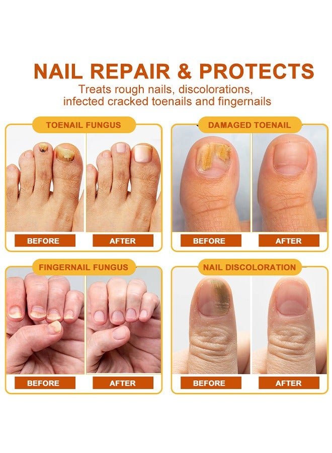 Sumifun - Bee Venom Fungal Nail Treatment Cream (Original) - Zambeel