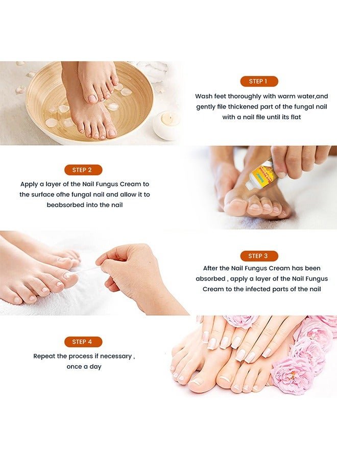 Sumifun - Bee Venom Fungal Nail Treatment Cream (Original) - Zambeel