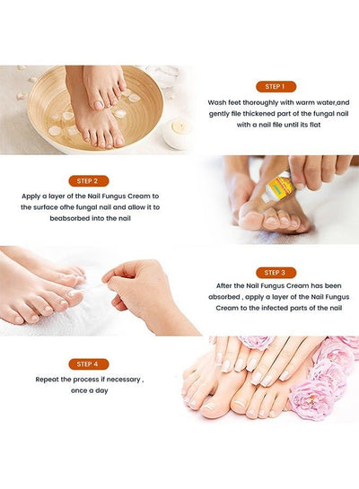 Sumifun - Bee Venom Fungal Nail Treatment Cream (Original) - Zambeel