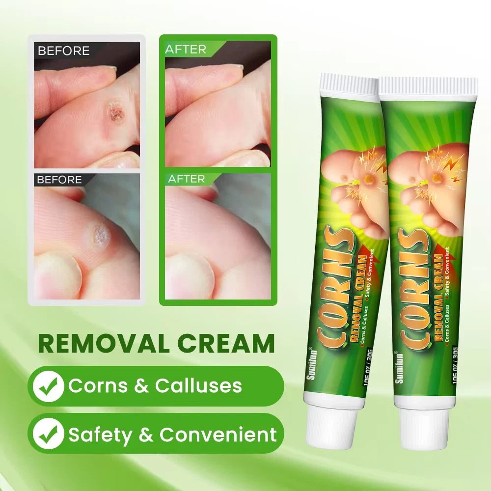 Sumifun - Corns Removal Cream - Zambeel