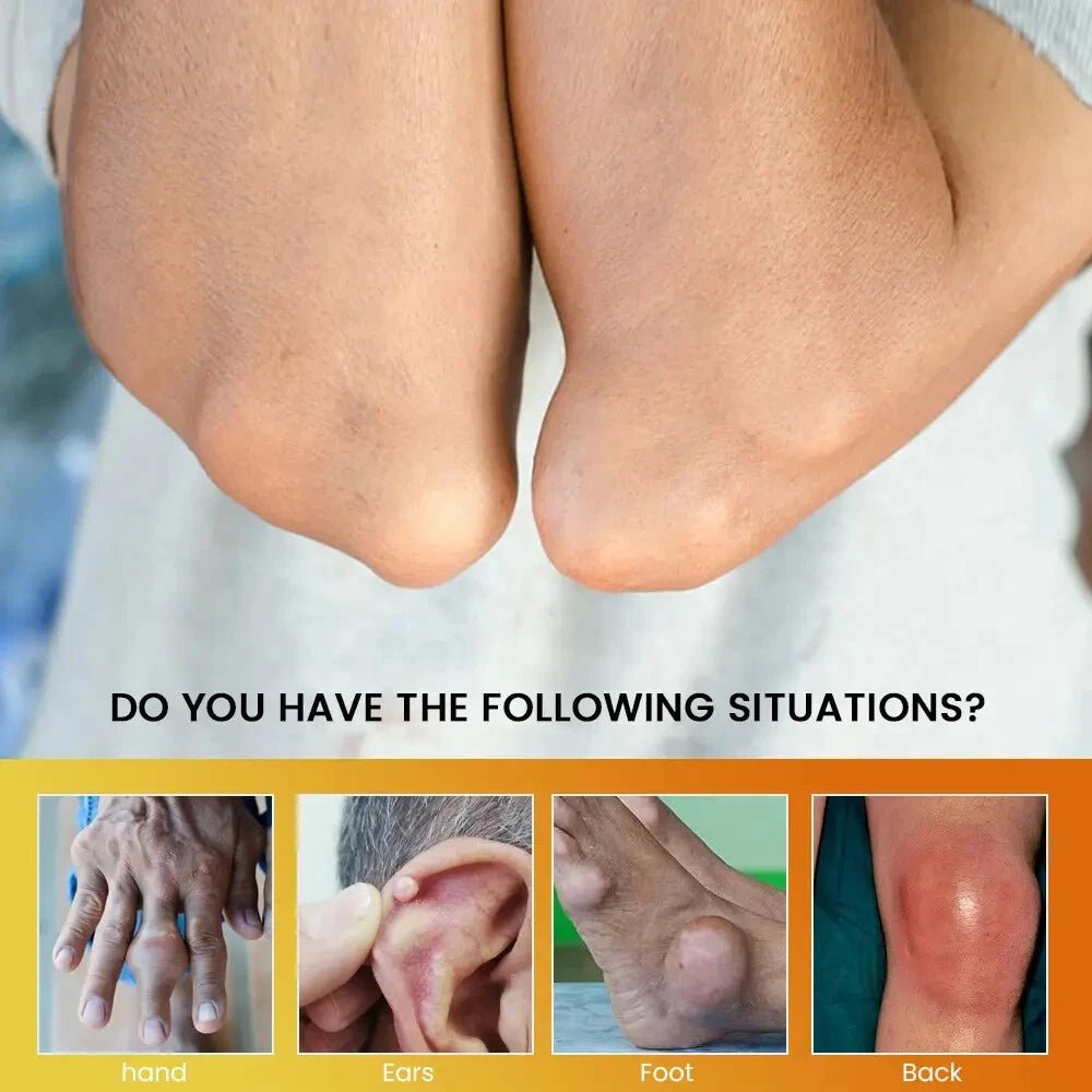 Sumifun - Gout Relief Cream (Original) - Zambeel