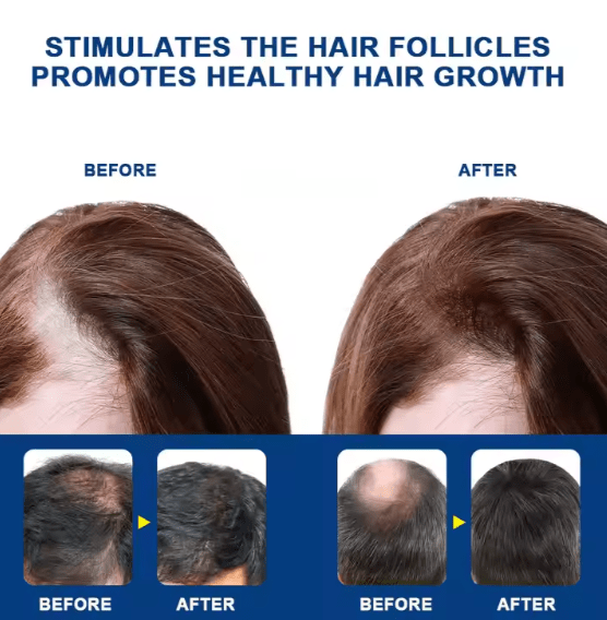 Sumifun - Hair Growth Cream - Zambeel