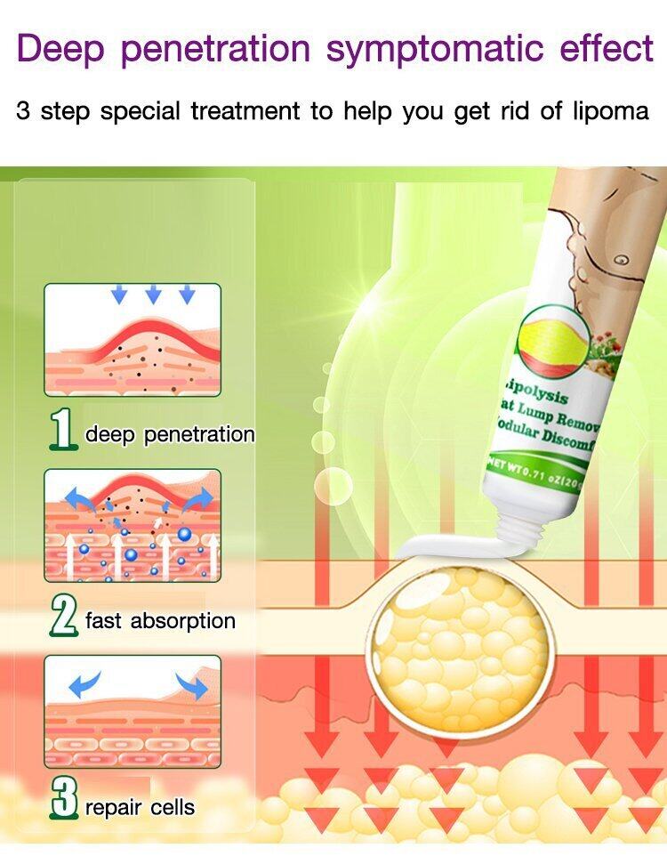 Sumifun - Lipoma Cream (Original) - Zambeel