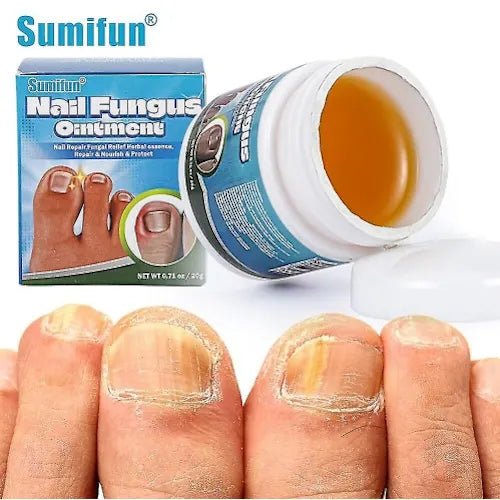 Sumifun - Nail Fungus Ointment (Original) - Zambeel