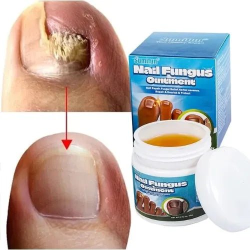 Sumifun - Nail Fungus Ointment (Original) - Zambeel