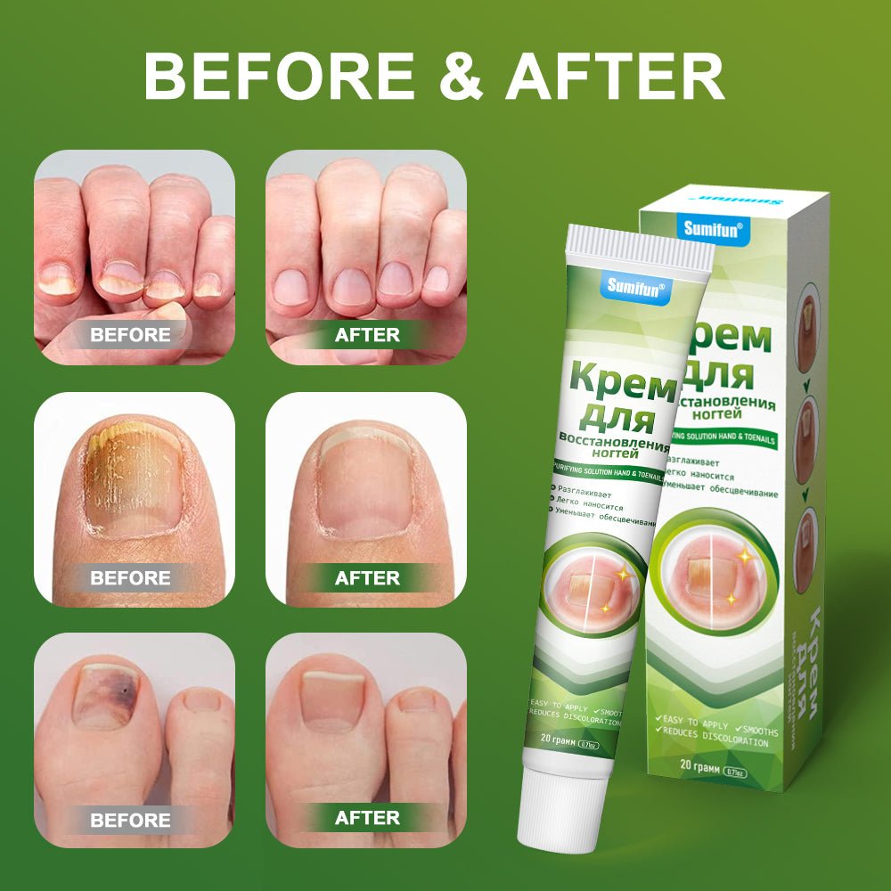 Sumifun - Nail Treatment Repair Gel (Original) - Zambeel
