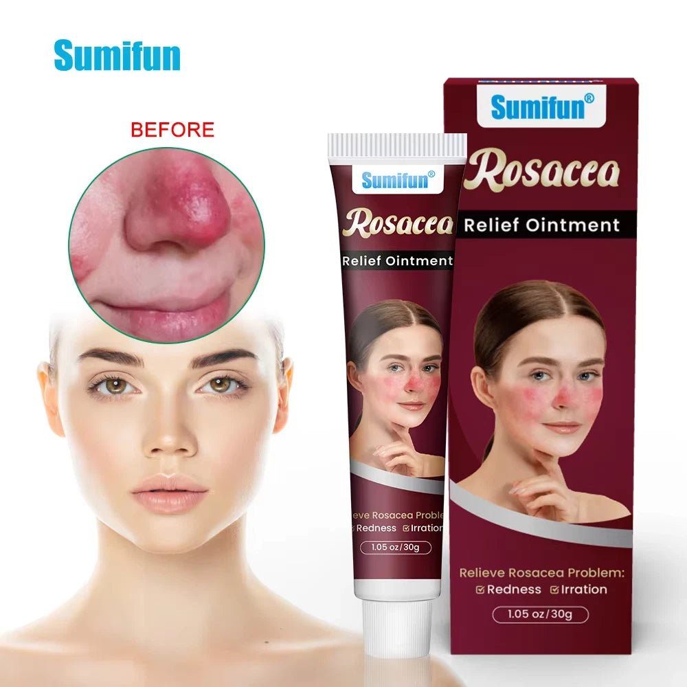 Sumifun - Rosacca Relief Ointment (Original) - Zambeel