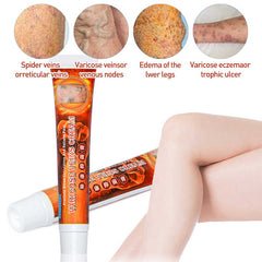 Sumifun - Varicose Veins Cream - Zambeel