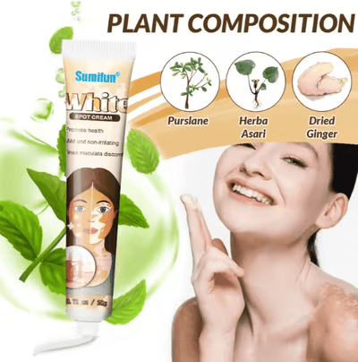 Sumifun - Vitiligo Removal Cream (Original) - Zambeel