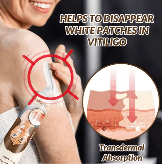 Sumifun - Vitiligo Removal Cream (Original) - Zambeel