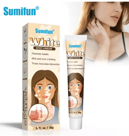 Sumifun - Vitiligo Removal Cream (Original) - Zambeel