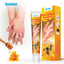 Summifun - Bee Venom Psoriasis Cream (Original) - Zambeel