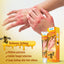Summifun - Bee Venom Psoriasis Cream (Original) - Zambeel