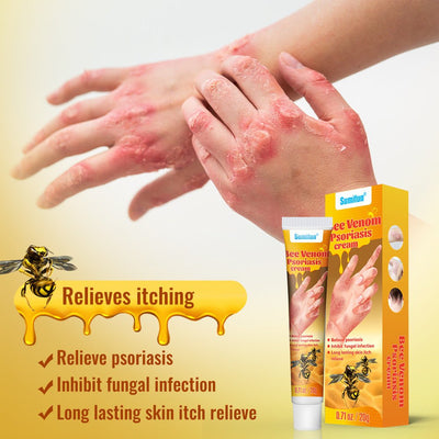 Summifun - Bee Venom Psoriasis Cream (Original) - Zambeel