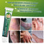 Summifun - Psoriasis Cream (Original) - Zambeel