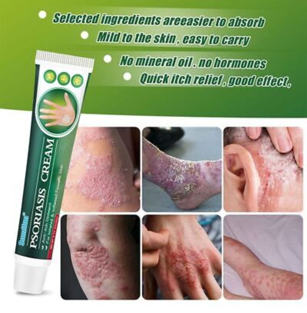 Summifun - Psoriasis Cream (Original) - Zambeel