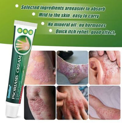 Summifun - Psoriasis Cream (Original) - Zambeel