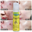 Temulawak - New Acne Removing Serum (Original) - Zambeel