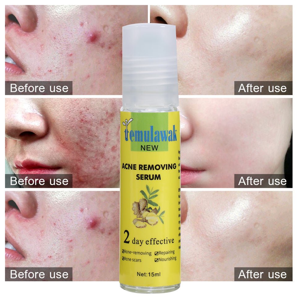 Temulawak - New Acne Removing Serum (Original) - Zambeel