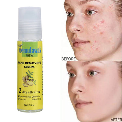 Temulawak - New Acne Removing Serum (Original) - Zambeel