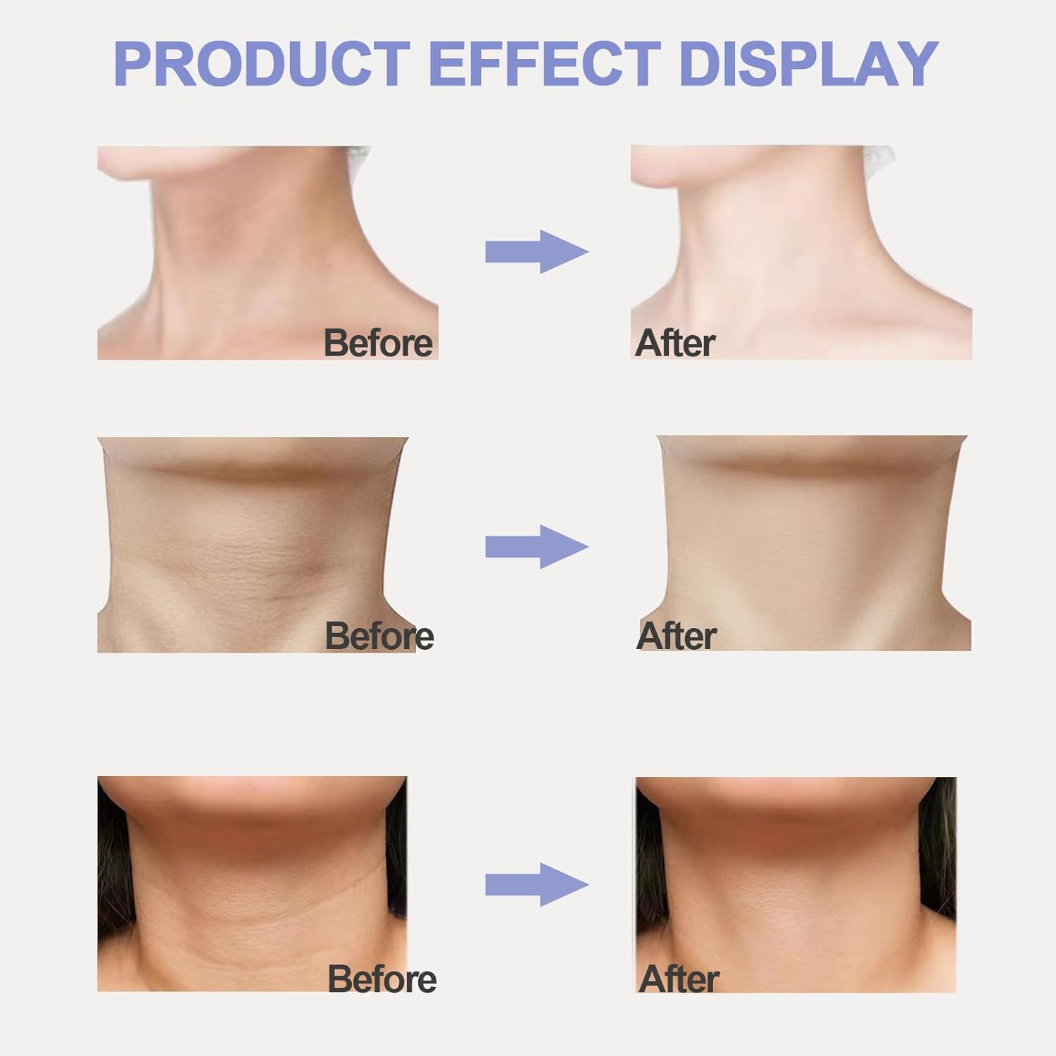 Tighten & Lift Neck Cream - Zambeel