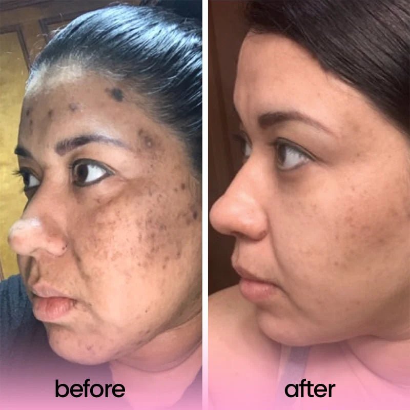 Turmeric Acid Cleaning Pads (Original) - Zambeel