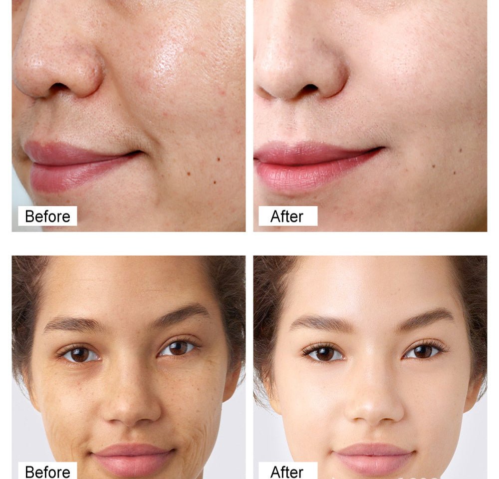 Vibrant Glamour - Retinol Cream - Zambeel