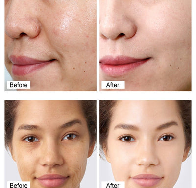 Vibrant Glamour - Retinol Cream - Zambeel