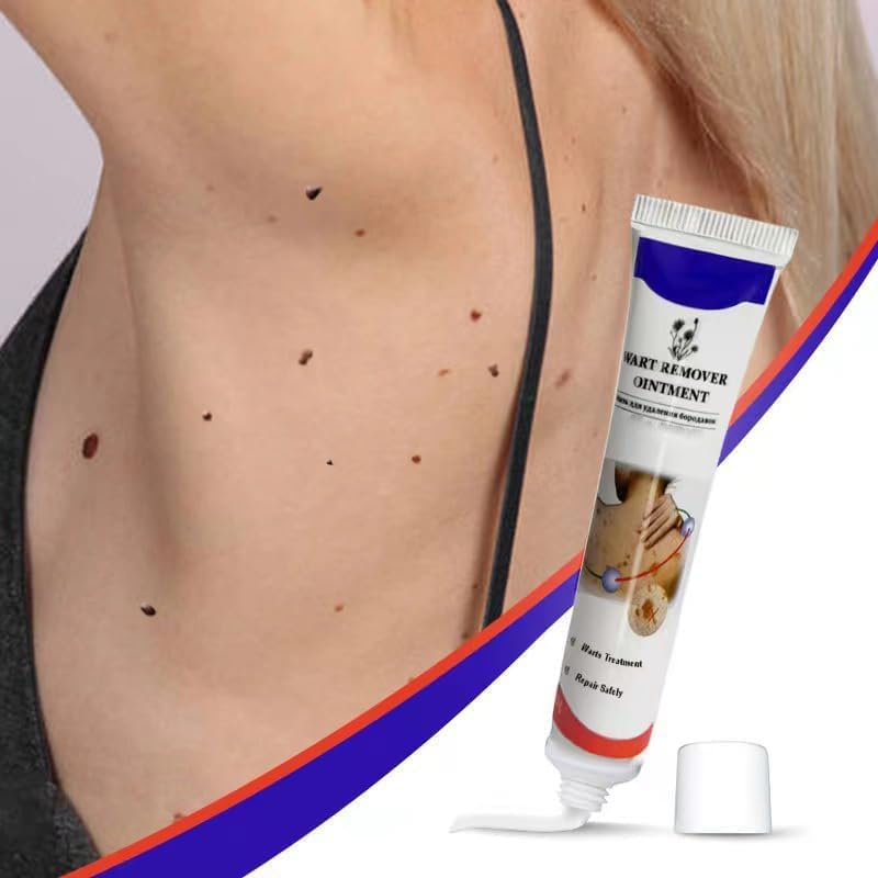 Warts Remover - Zambeel