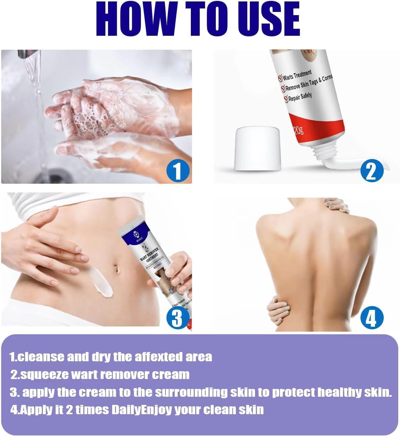 Warts Remover - Zambeel