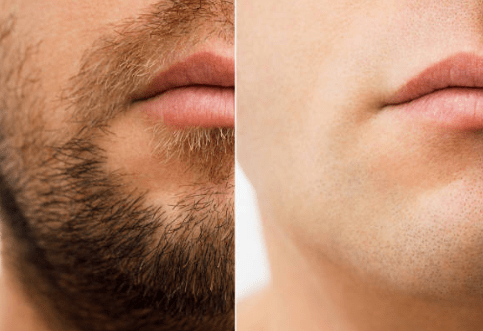 WMARK - Professional Hair Clipper © - Zambeel